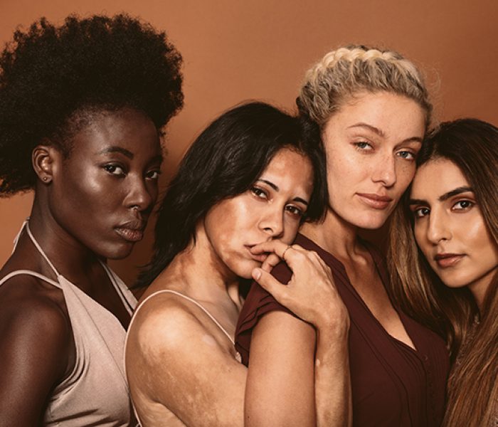 Portrait of young women friends with different skin types. Diverse group of females standing together and looking at camera.